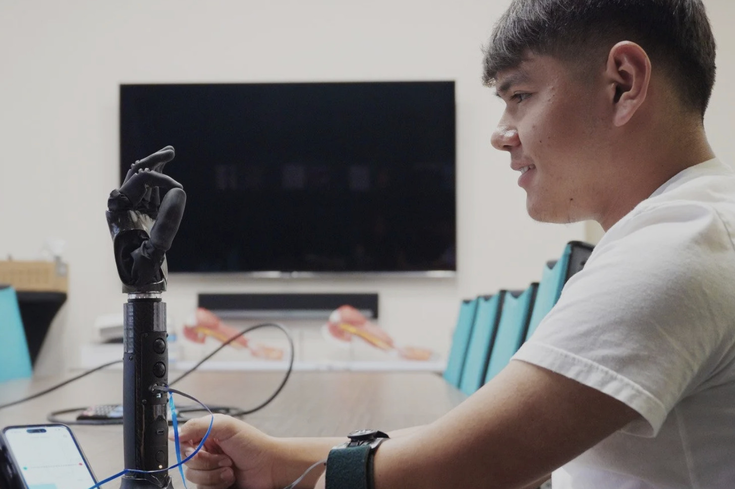 仿生學(xué)與復(fù)合材料的融合：上肢假肢功能修復(fù)的革命性突破