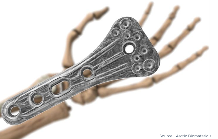 通過AFP技術增強植入物整合的天然礦物纖維生物復合材料 通過AFP技術增強植入物整合的天然礦物纖維生物復合材料