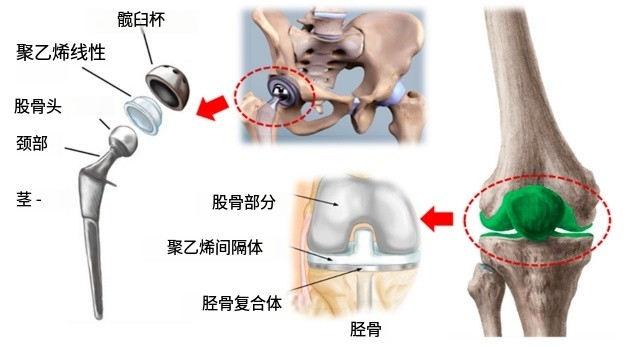超高分子量聚乙烯在生物醫(yī)學(xué)應(yīng)用中的性能與功能化綜述