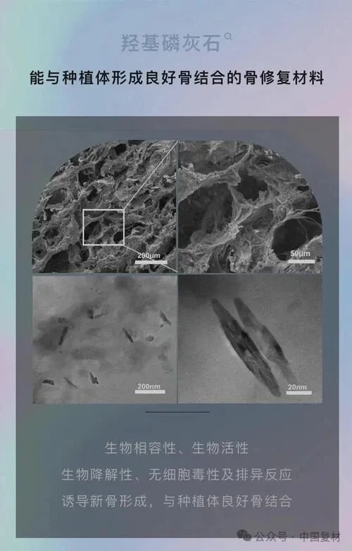 骨修復用鈦合金-羥基磷灰石復合材料的制備工藝及性能 骨修復用鈦合金-羥基磷灰石復合材料的制備工藝及性能